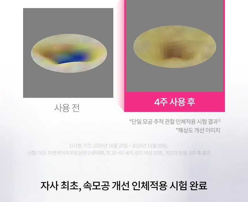 [윈터PICK/ 1등모공앰플/유리알결광세럼] AHC 프로샷 포어이레이저 세럼 30ml 기획 (+10ml) 상세페이지 14